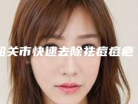 韶关市快速去除祛痘痘疤医生上榜清单榜上理由可查-李远标医生口碑擅长各不同